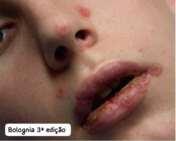 Diagnostic 1