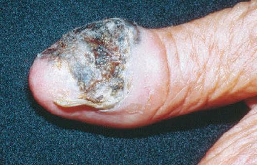 Diagnostic 5