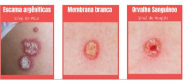 Diagnostic 3