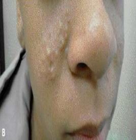 Diagnostic 1